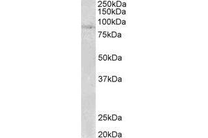 Western Blotting (WB) image for anti-SET Domain, Bifurcated 2 (SETDB2) (N-Term) antibody (ABIN2465045) (SETDB2 Antikörper  (N-Term))