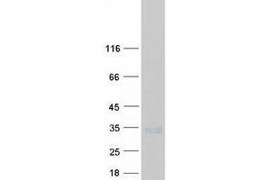 Validation with Western Blot (SEC22A Protein (Myc-DYKDDDDK Tag))