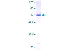 AKR1A1 Protein (AA 1-325) (GST tag)