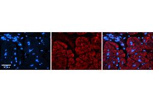 Rabbit Anti-AKAP7 Antibody    Formalin Fixed Paraffin Embedded Tissue: Human Adult heart  Observed Staining: Membrane, Cytoplasmic Primary Antibody Concentration: 1:600 Secondary Antibody: Donkey anti-Rabbit-Cy2/3 Secondary Antibody Concentration: 1:200 Magnification: 20X Exposure Time: 0.