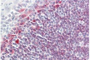 Image no. 1 for anti-B-cell antigen receptor complex-associated protein alpha chain (CD79A) (AA 202-216), (Cytoplasmic Domain) antibody (ABIN1502296)