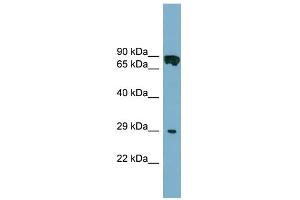 WB Suggested Anti-CYB5D1 Antibody Titration: 0. (CYB5D1 Antikörper  (Middle Region))