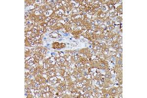 Immunohistochemistry (IHC) image for anti-High Density Lipoprotein Binding Protein (HDLBP) (AA 1035-1268) antibody (ABIN6141701)