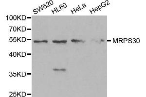 Western blot analysis of extracts of various cell lines, using MRPS30 antibody. (MRPS30 Antikörper)