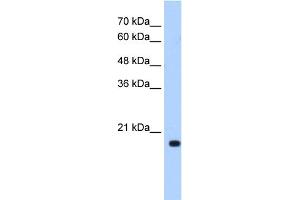 WB Suggested Anti-XTP3TPA Antibody Titration:  0. (DCTPP1 Antikörper  (N-Term))