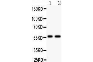 Anti- PIAS4 antibody, Western blotting All lanes: Anti PIAS4  at 0. (PIAS4 Antikörper  (C-Term))