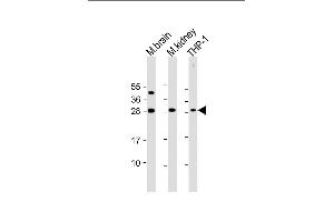 All lanes : Anti-TPD52 Antibody (N-Term) at 1:2000 dilution Lane 1: mouse brain lysate Lane 2: mouse kidney lysate Lane 3: THP-1 whole cell lysate Lysates/proteins at 20 μg per lane. (TPD52 Antikörper  (AA 11-44))