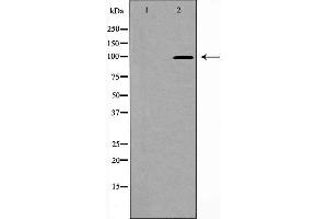 Western blot analysis of PSD95 expression in Brain (Rat) Tissue Lysate,The lane on the left is treated with the antigen-specific peptide. (DLG4 Antikörper  (C-Term))