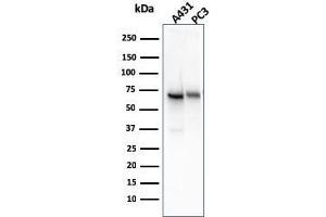 Western Blot Analysis of A431 and PC-3 cell lysate using CD73 Mouse Monoclonal Antibody (NT5E/2545). (CD73 Antikörper)