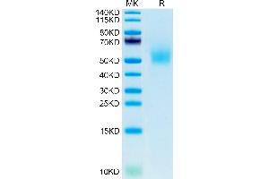 Mouse DLK1 on Tris-Bis PAGE under reduced condition. (DLK1 Protein (AA 24-305) (His tag))