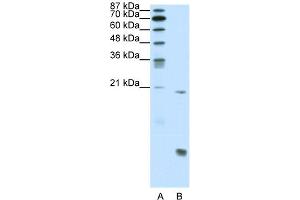 WB Suggested Anti-RUNX1 Antibody Titration:  0. (RUNX1 Antikörper  (N-Term))