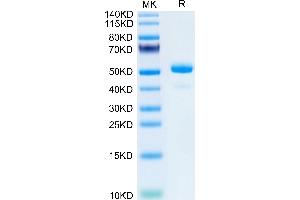 SDS-PAGE (SDS) image for Lipocalin 2 (LCN2) (AA 21-200) protein (Fc Tag) (ABIN7275322)