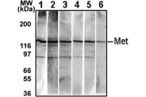 Western Blotting (WB) image for anti-Met Proto-Oncogene (MET) antibody (ABIN2995275) (c-MET Antikörper)