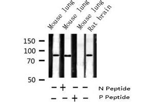 Western blot analysis of Phospho-IKK beta (Tyr199) expression in various lysates (IKBKB Antikörper  (pTyr199))
