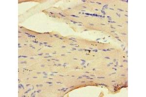 Immunohistochemistry of paraffin-embedded human skeletal muscle tissue using ABIN7161435 at dilution of 1:100 (NRP2 Antikörper  (AA 60-209))