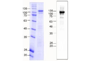 CDH6 Protein (AA 54-615) (MBP tag)