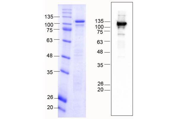 CDH6 Protein (AA 54-615) (MBP tag)