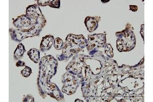 Immunoperoxidase of monoclonal antibody to NEDD1 on formalin-fixed paraffin-embedded human placenta. (NEDD1 Antikörper  (AA 561-660))