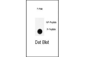 Dot blot analysis of anti-Phospho-GIT1-p Antibody (ABIN389936 and ABIN2839750) on nitrocellulose membrane. (GIT1 Antikörper  (pTyr554))