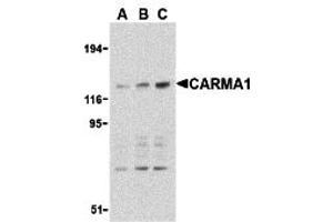 Western Blotting (WB) image for anti-Caspase Recruitment Domain Family, Member 11 (CARD11) (C-Term) antibody (ABIN1030313) (CARD11 Antikörper  (C-Term))