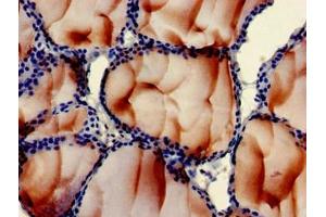 Immunohistochemistry of paraffin-embedded human thyroid tissue using ABIN7163564 at dilution of 1:100 (Plastin 3 Antikörper  (AA 310-455))