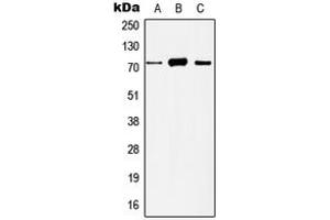 Western blot analysis of Histone Deacetylase 10 expression in HeLa (A), Jurkat (B), mouse liver (C), rat liver (D) whole cell lysates. (HDAC10 Antikörper  (N-Term))