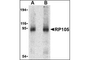 Western blot analysis of RP105 in human spleen tissue lysate with this product at (A) 0. (CD180 Antikörper  (Center))