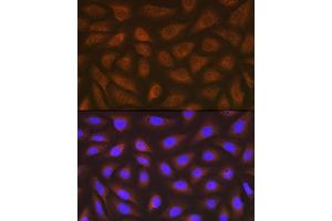 Immunofluorescence analysis of U-2 OS cells using eEF2 Rabbit mAb (ABIN7267025) at dilution of 1:100 (40x lens). (EEF2 Antikörper)