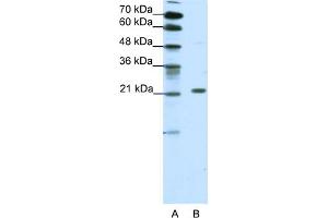 WB Suggested Anti-CBX1 Antibody Titration:  1.