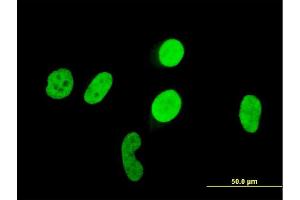 Immunofluorescence of monoclonal antibody to RUNX1 on HeLa cell. (RUNX1 Antikörper  (AA 210-310))