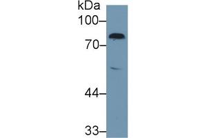 Western Blot; Sample: Rat Serum; Primary Ab: 1µg/ml Rabbit Anti-Rat F2 Antibody Second Ab: 0. (Prothrombin Antikörper  (AA 44-200))