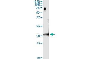 Immunoprecipitation (IP) image for anti-Centromere Protein M (CENPM) (AA 1-180) antibody (ABIN566326)