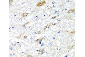 Immunohistochemistry of paraffin-embedded Rat brain using CPA6 Polyclonal Antibody at dilution of 1:100 (40x lens). (CPA6 Antikörper)