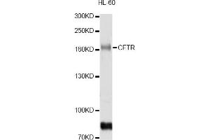 Western blot analysis of extracts of HL-60 cells, using CFTR antibody (ABIN5974674) at 1/1000 dilution. (CFTR Antikörper)