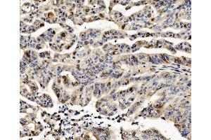 IHC analysis of CCNB1 using anti-CCNB1 antibody (ABIN7599335). (Cyclin B1 Antikörper  (AA 1-383))