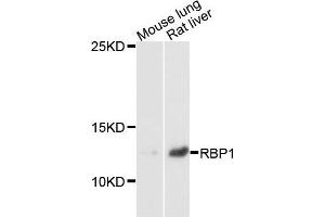 Western blot analysis of extracts of mouse lung and rat liver cells, using RBP1 antibody. (RBP1 Antikörper)