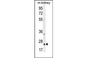 Western blot analysis of HOXB6 / HOX2B Antibody (Center) in mouse kidney tissue lysates (35ug/lane). (HOXB6 Antikörper  (Middle Region))