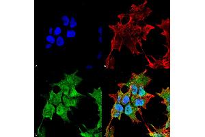 Immunocytochemistry/Immunofluorescence analysis using Mouse Anti-SUR1 Monoclonal Antibody, Clone S289-16 . (ABCC8 Antikörper  (AA 1548-1582) (Atto 594))