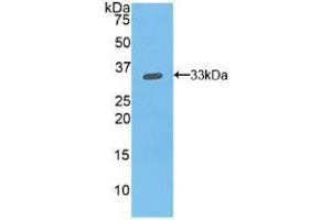 Western blot analysis of recombinant Mouse ITGb1.
