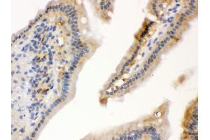 Immunohistochemistry (Paraffin-embedded Sections) (IHC (p)) image for anti-Heat Shock 70kDa Protein 1A (HSPA1A) (AA 559-596), (C-Term) antibody (ABIN3043849) (HSP70 1A Antikörper  (C-Term))