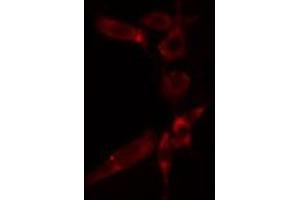 ABIN6277280 staining  HuvEc cells by IF/ICC. (AIF Antikörper  (C-Term))