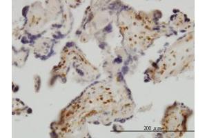 Image no. 1 for anti-Exosome Component 8 (EXOSC8) (AA 1-277) antibody (ABIN599183) (EXOSC8 Antikörper  (AA 1-277))