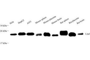 Western blot analysis of LITAF (ABIN7074508),at dilution of 1: 2000 (LITAF Antikörper)