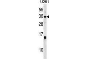 Western blot analysis in U251 cell line lysates (35ug/lane) using Stanniocalcin-1 / STC1 Antibody (C-term).
