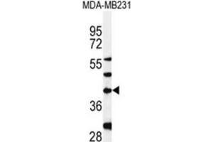 Western Blotting (WB) image for anti-Dolichyl-Phosphate (UDP-N-Acetylglucosamine) N-acetylglucosaminephosphotransferase 1 (GlcNAc-1-P Transferase) (DPAGT1) antibody (ABIN3004399) (DPAGT1 Antikörper)