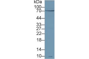 Detection of zAP70 in Human Jurkat cell lysate using Polyclonal Antibody to Zeta Chain Associated Protein Kinase 70 kDa (zAP70) (ZAP70 Antikörper  (AA 337-600))