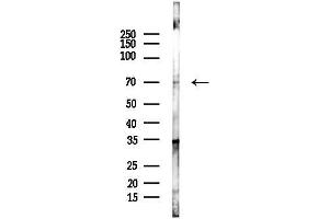 anti-Grainyhead-Like 2 (GRHL2) antibody