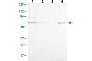 Western blot analysis of Lane 1: Human cell line RT-4 Lane 2: Human cell line U-251MG sp Lane 3: Human plasma (IgG/HSA depleted) Lane 4: Human liver tissue with ZNF550 polyclonal antibody . (ZNF550 Antikörper)