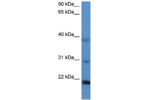 WB Suggested Anti-IMMP2L Antibody Titration: 0.