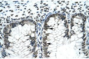 Rabbit Anti-GLI2 Antibody  Paraffin Embedded Tissue: Human Intestine Cellular Data: Epithelial cells of intestinal gland Antibody Concentration: 4. (GLI2 Antikörper  (Middle Region))